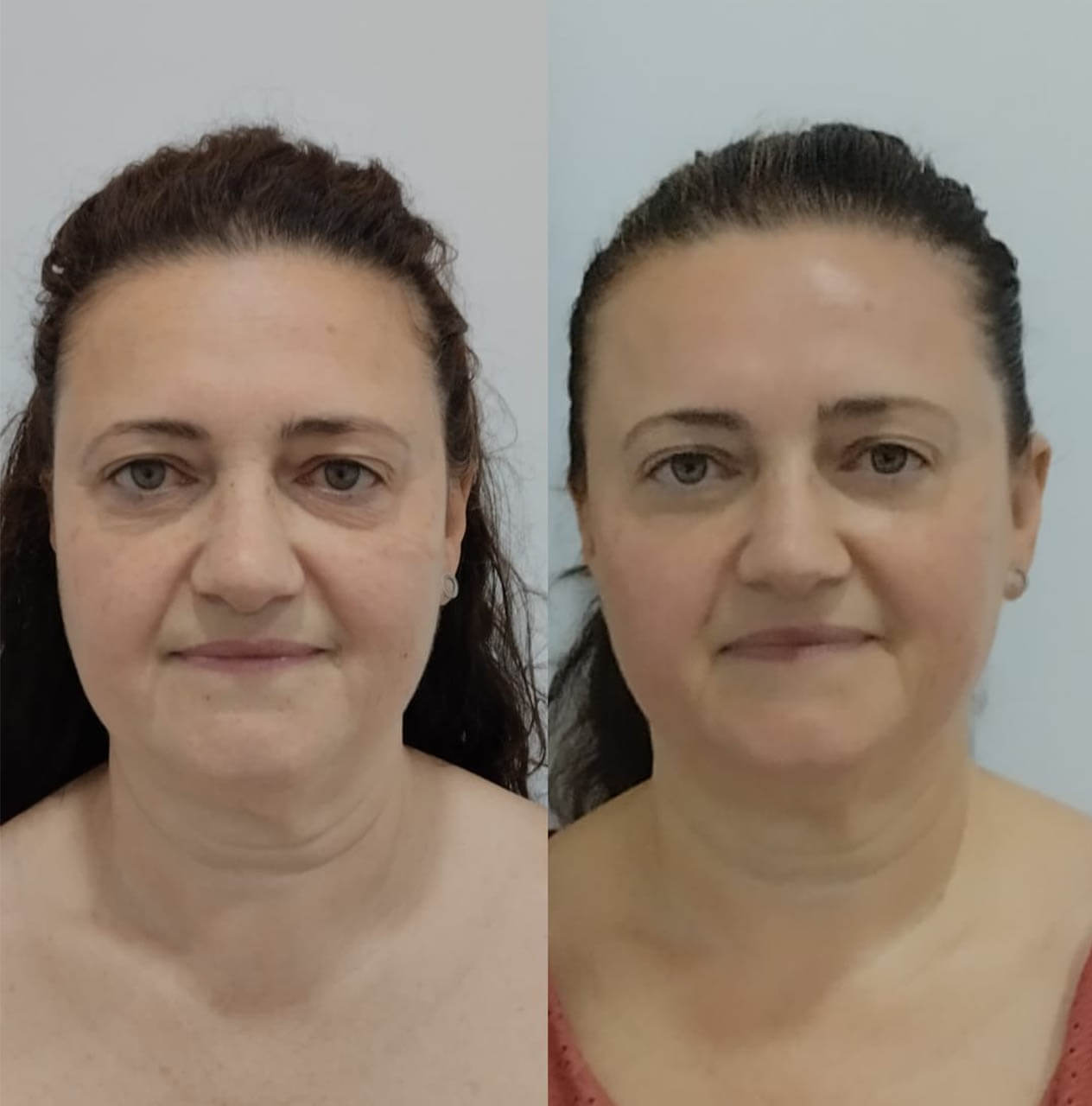 fotos-kenesiocoach_0003_imgi_13_IMG_1176