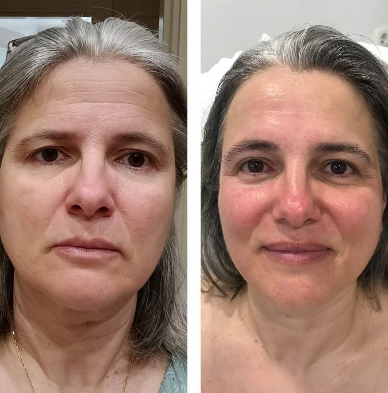 fotos-kenesiocoach_0004_imgi_12_PHOTO-2023-06-20-17-47-37